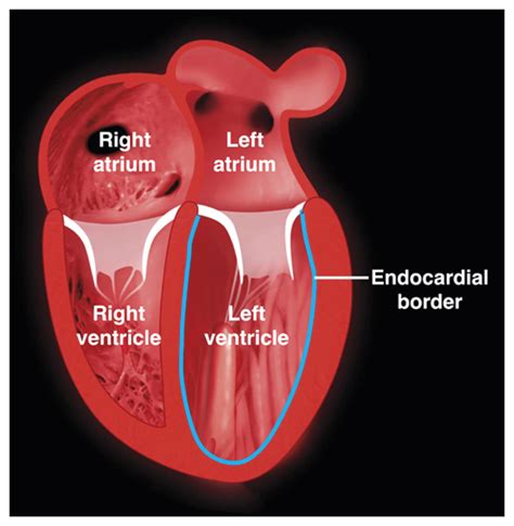 lv functie|Left Ventricular Function – Cardiovascular Education.